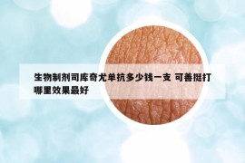 生物制劑司庫奇尤單抗多少錢一支 可善挺打哪里效果最好