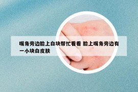 嘴角旁邊臉上白塊幫忙看看 臉上嘴角旁邊有一小塊白皮膚