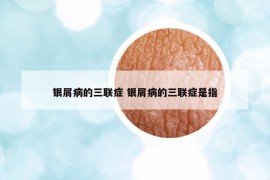銀屑病的三聯(lián)癥 銀屑病的三聯(lián)癥是指