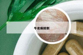 牛皮癬挑刺