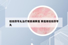桂枝茯苓丸治療銀屑病黃煌 黃煌用桂枝茯苓丸