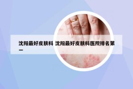 沈陽(yáng)最好皮膚科 沈陽(yáng)最好皮膚科醫(yī)院排名第一