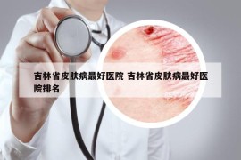 吉林省皮膚病最好醫(yī)院 吉林省皮膚病最好醫(yī)院排名