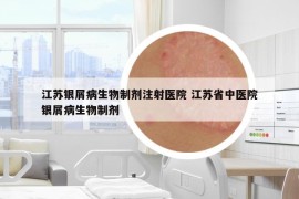 江蘇銀屑病生物制劑注射醫(yī)院 江蘇省中醫(yī)院銀屑病生物制劑