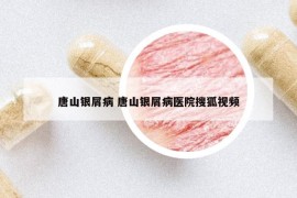 唐山銀屑病 唐山銀屑病醫(yī)院搜狐視頻