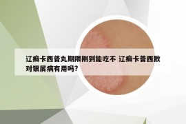 遼癬卡西普丸期限剛到能吃不 遼癬卡普西散對(duì)銀屑病有用嗎?