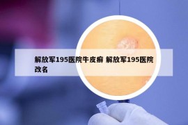 解放軍195醫(yī)院牛皮癬 解放軍195醫(yī)院改名