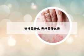 光療是什么 光療是什么光