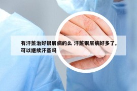 有汗蒸治好銀屑病的么 汗蒸銀屑病好多了,可以繼續(xù)汗蒸嗎