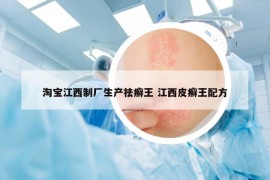 淘寶江西制廠生產(chǎn)祛癬王 江西皮癬王配方