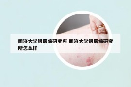 同濟(jì)大學(xué)銀屑病研究所 同濟(jì)大學(xué)銀屑病研究所怎么樣