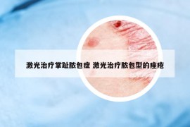 激光治療掌趾膿包癥 激光治療膿包型的痤瘡