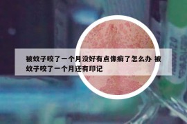 被蚊子咬了一個(gè)月沒好有點(diǎn)像癬了怎么辦 被蚊子咬了一個(gè)月還有印記