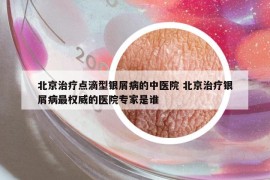 北京治療點滴型銀屑病的中醫(yī)院 北京治療銀屑病最權(quán)威的醫(yī)院專家是誰