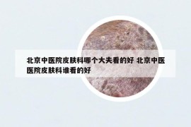 北京中醫(yī)院皮膚科哪個大夫看的好 北京中醫(yī)醫(yī)院皮膚科誰看的好