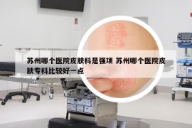 蘇州哪個(gè)醫(yī)院皮膚科是強(qiáng)項(xiàng) 蘇州哪個(gè)醫(yī)院皮膚?？票容^好一點(diǎn)