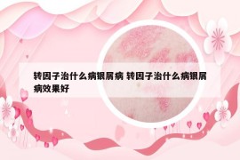 轉(zhuǎn)因子治什么病銀屑病 轉(zhuǎn)因子治什么病銀屑病效果好