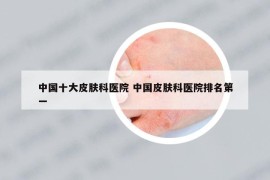 中國十大皮膚科醫(yī)院 中國皮膚科醫(yī)院排名第一