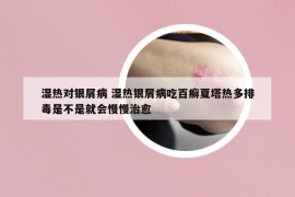 濕熱對(duì)銀屑病 濕熱銀屑病吃百癬夏塔熱多排毒是不是就會(huì)慢慢治愈