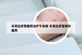 石家莊武警醫(yī)院治療牛皮癬 石家莊武警男科醫(yī)院