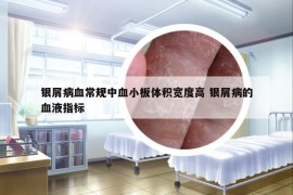 銀屑病血常規(guī)中血小板體積寬度高 銀屑病的血液指標