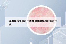 草本膚疾克是治什么的 草本膚癢洗劑能治什么