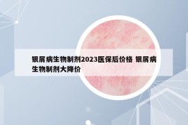 銀屑病生物制劑2023醫(yī)保后價(jià)格 銀屑病生物制劑大降價(jià)