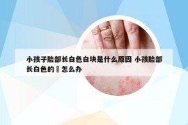 小孩子臉部長白色白塊是什么原因 小孩臉部長白色的痠怎么辦