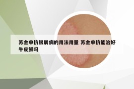 蘇金單抗銀屑病的用法用量 蘇金單抗能治好牛皮鮮嗎