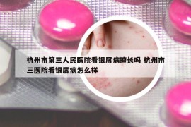 杭州市第三人民醫(yī)院看銀屑病擅長(zhǎng)嗎 杭州市三醫(yī)院看銀屑病怎么樣