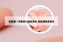 銀屑病一天要用幾回身體乳 銀屑病擦身體乳