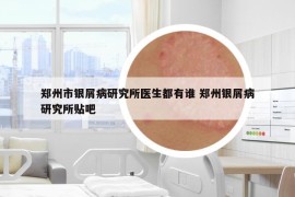 鄭州市銀屑病研究所醫(yī)生都有誰 鄭州銀屑病研究所貼吧