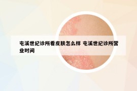 屯溪世紀(jì)診所看皮膚怎么樣 屯溪世紀(jì)診所營業(yè)時間