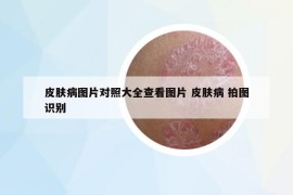 皮膚病圖片對照大全查看圖片 皮膚病 拍圖識別