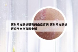 醫(yī)科院皮膚病研究所南京官網(wǎng) 醫(yī)科院皮膚病研究所南京官網(wǎng)電話