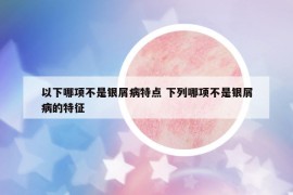 以下哪項(xiàng)不是銀屑病特點(diǎn) 下列哪項(xiàng)不是銀屑病的特征