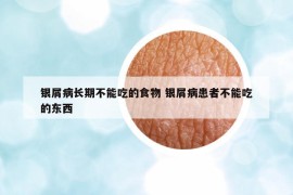 銀屑病長期不能吃的食物 銀屑病患者不能吃的東西