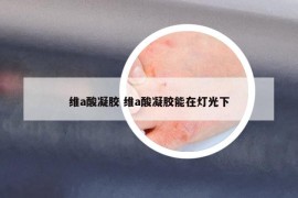 維a酸凝膠 維a酸凝膠能在燈光下