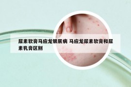 尿素軟膏馬應(yīng)龍銀屑病 馬應(yīng)龍尿素軟膏和尿素乳膏區(qū)別