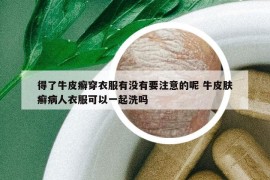得了牛皮癬穿衣服有沒有要注意的呢 牛皮膚癬病人衣服可以一起洗嗎