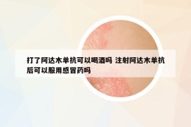 打了阿達(dá)木單抗可以喝酒嗎 注射阿達(dá)木單抗后可以服用感冒藥嗎