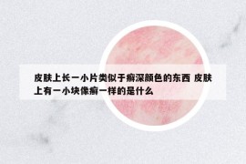 皮膚上長(zhǎng)一小片類(lèi)似于癬深顏色的東西 皮膚上有一小塊像癬一樣的是什么