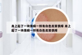 身上起了一塊像癬一樣有白色皮屑很癢 身上起了一塊像癬一樣有白色皮屑很癢