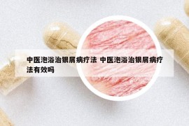 中醫(yī)泡浴治銀屑病療法 中醫(yī)泡浴治銀屑病療法有效嗎