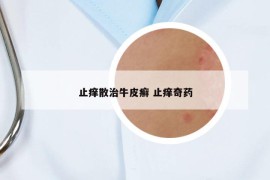止癢散治牛皮癬 止癢奇藥