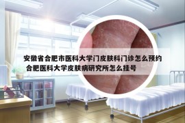 安徽省合肥市醫(yī)科大學(xué)門皮膚科門診怎么預(yù)約 合肥醫(yī)科大學(xué)皮膚病研究所怎么掛號