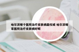 哈爾濱哪個(gè)醫(yī)院治療皮膚病最權(quán)威 哈爾濱哪家醫(yī)院治療皮膚病好呢