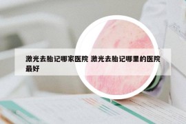 激光去胎記哪家醫(yī)院 激光去胎記哪里的醫(yī)院最好