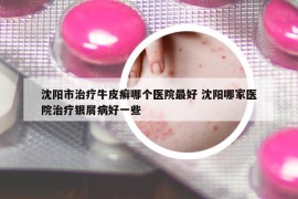 沈陽市治療牛皮癬哪個醫(yī)院最好 沈陽哪家醫(yī)院治療銀屑病好一些