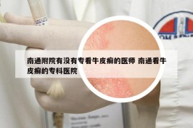 南通附院有沒有?？磁Ｆぐ_的醫(yī)師 南通看牛皮癬的?？漆t(yī)院